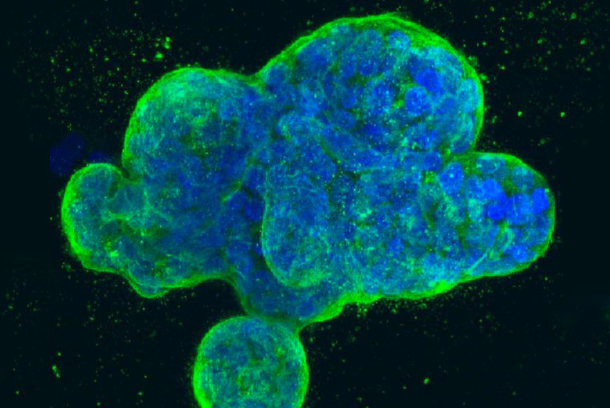 Учёные "убили" рак крови стволовыми клетками